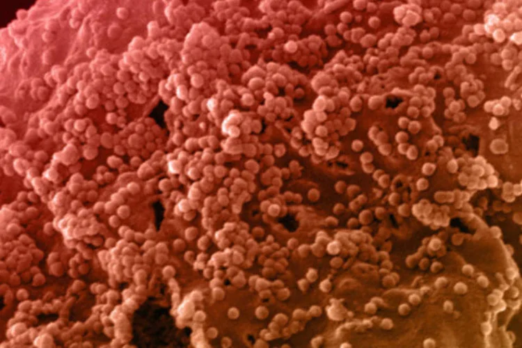 Célula com HIV: publicação tem capítulos dedicados a cardiologia, doenças infecciosas, endocrinologia, hematologia, nefrologia e neurologia, todos coordenados por especialistas (Getty Images)
