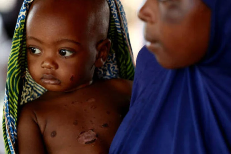 
	Uma mulher espera com seu filho para ver um m&eacute;dico em uma cl&iacute;nica na vila Bagega, na Nig&eacute;ria
 (REUTERS/Akintunde Akinleye)