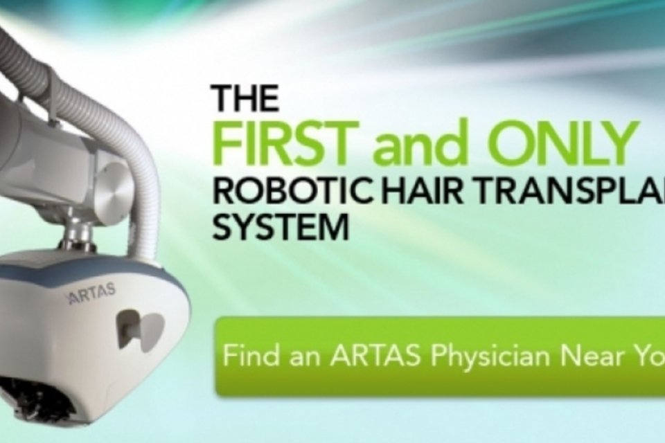 Robô que faz transplante capilar chega ao Brasil