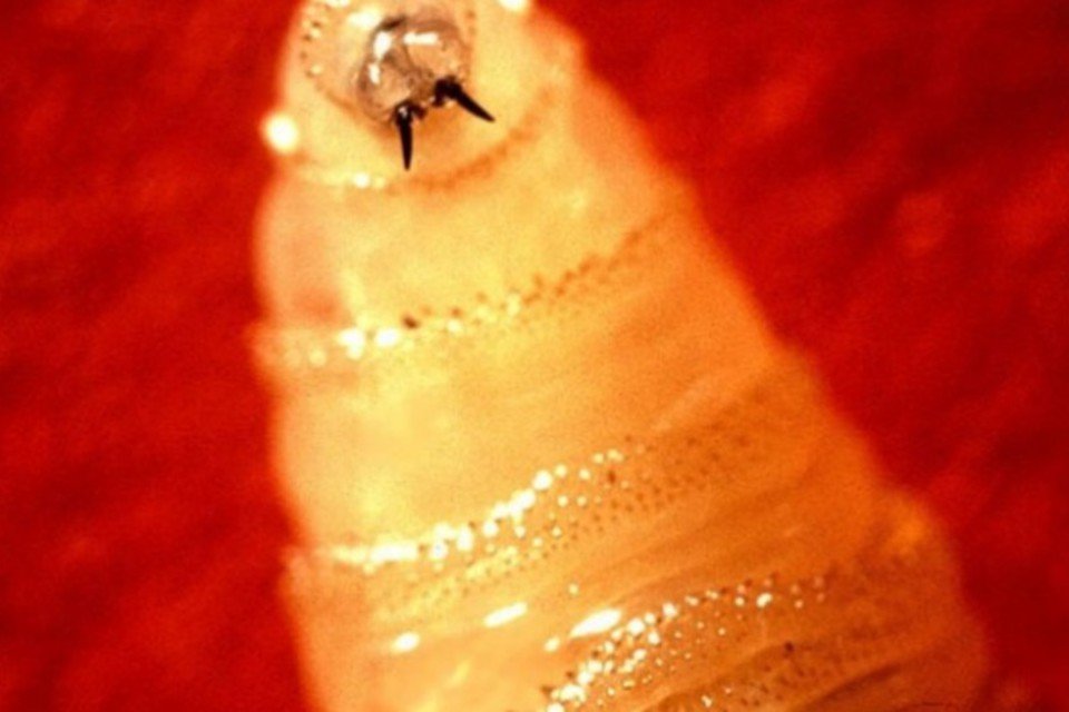 Britânica descobre larvas no ouvido após viagem ao Peru