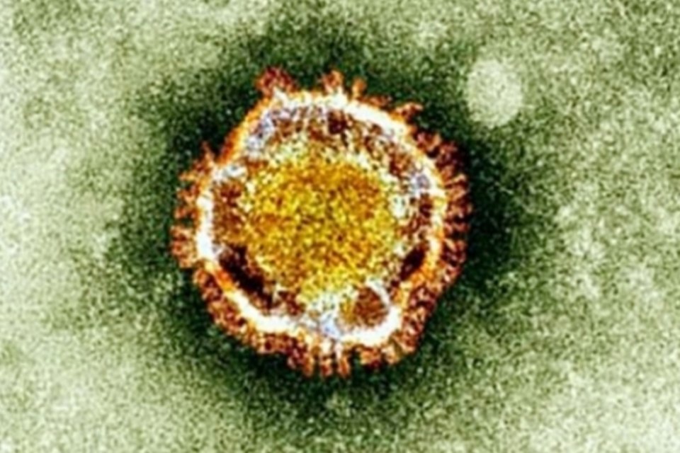 Coronavírus já matou mais de 100 na Arábia Saudita