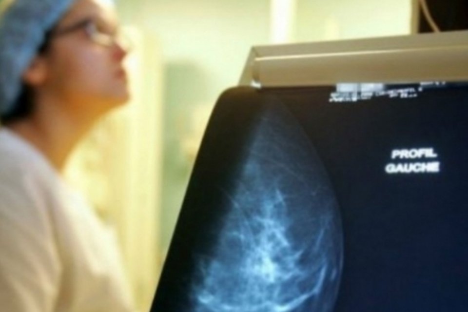 Gene do câncer de mama pode aumentar risco de doença no pulmão