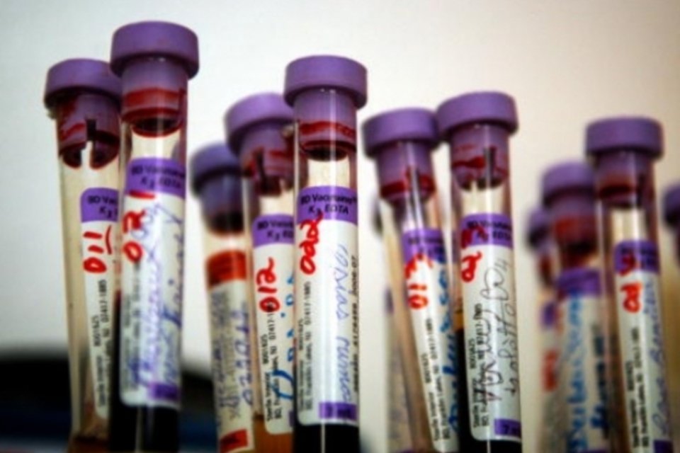 Camboja investiga contágio maciço por HIV em aldeia do país