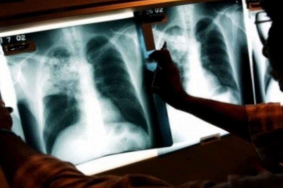 Tuberculose afeta um milhão de crianças por ano