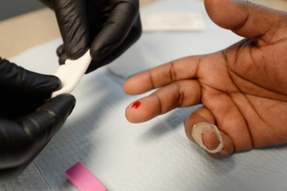 Brasil terá teste de Aids vendido em farmácia