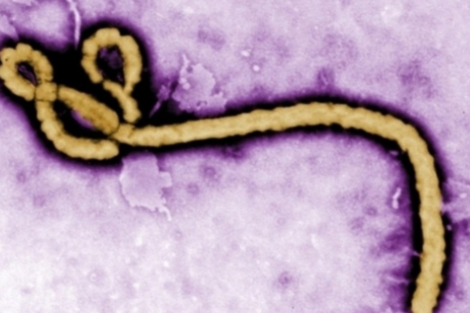 Japão pode oferecer medicamento sem aprovação para Ebola