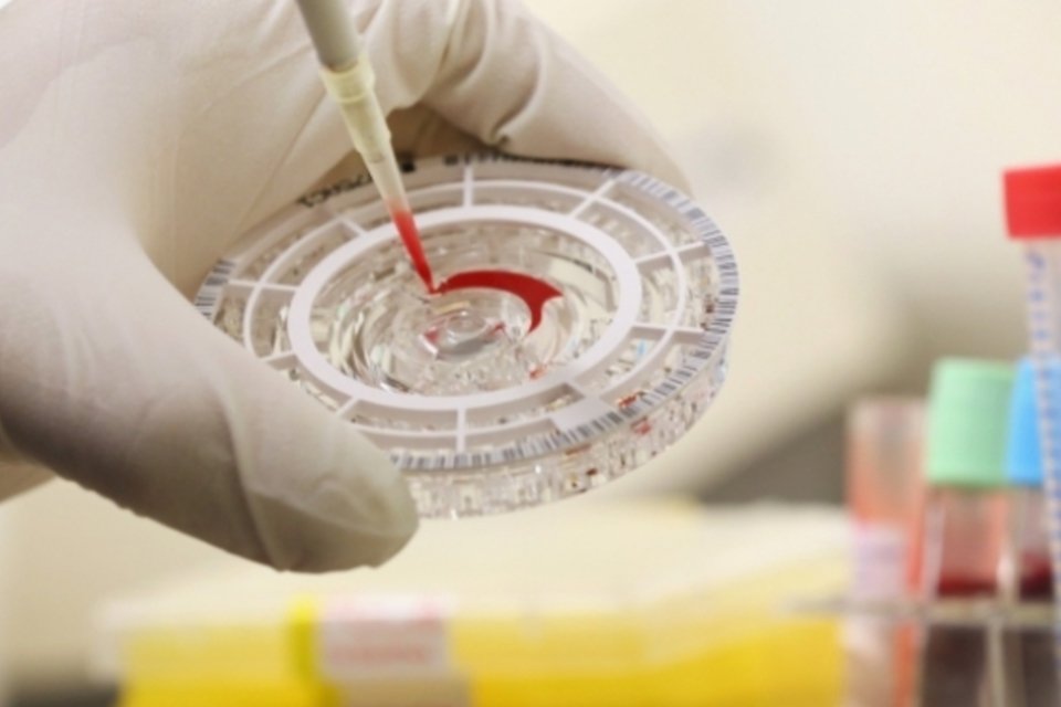 Testes de vacina contra o Ebola serão acelerados
