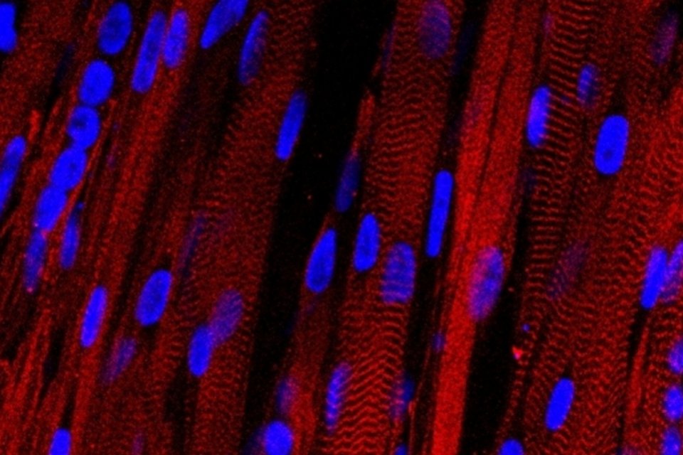 Cientistas criam músculo artificial que consegue se contrair
