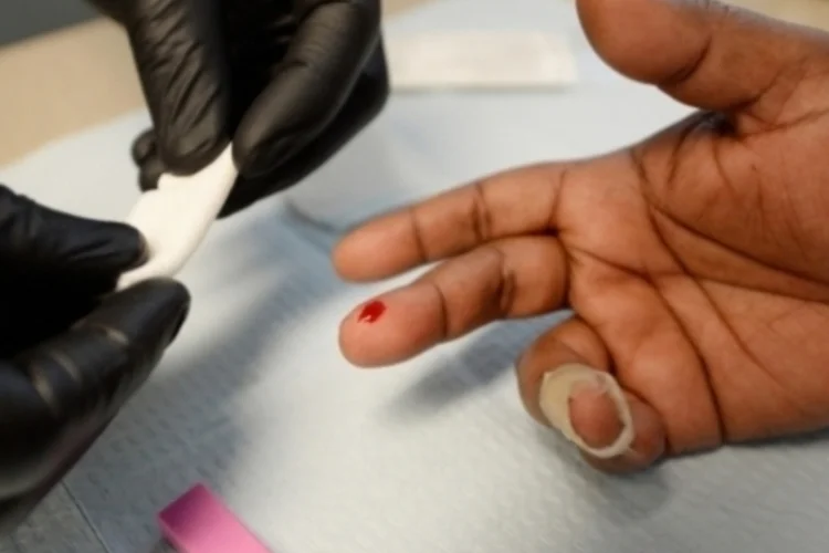 teste hiv (Getty Images)