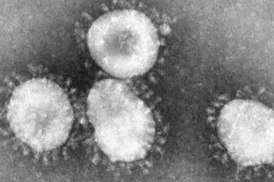 Coronavírus já mataram quase 300 na Arábia Saudita desde 2012