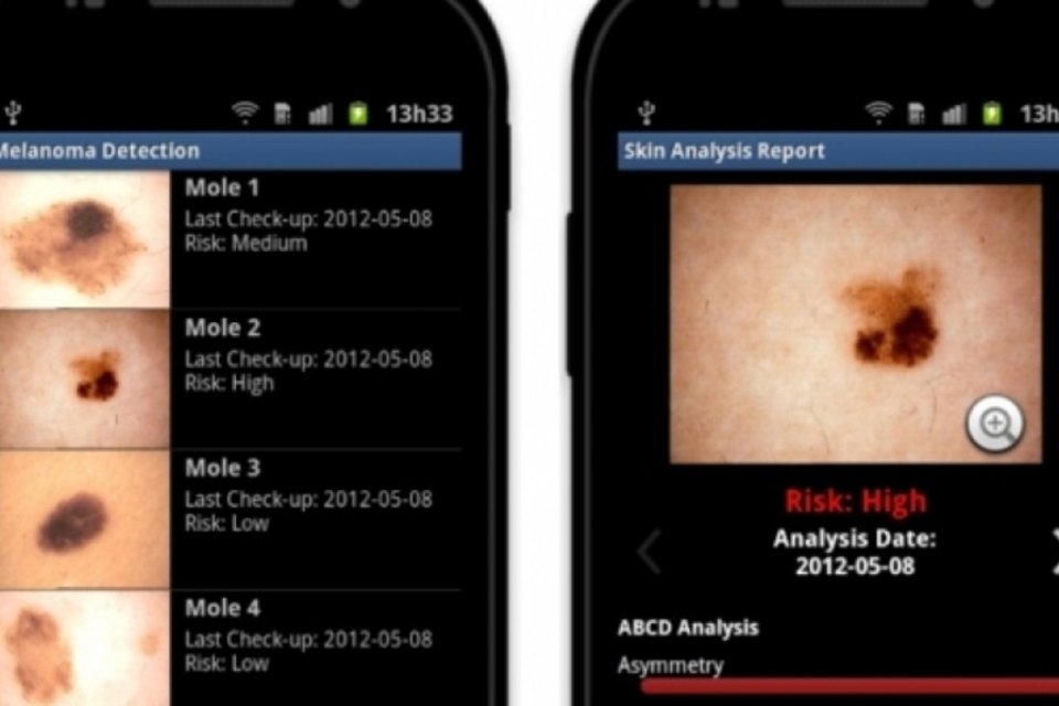Aplicativos que prometem detectar câncer de pele são multados nos EUA