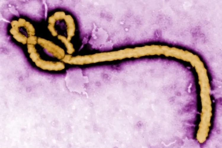 Ebola (Getty Images)