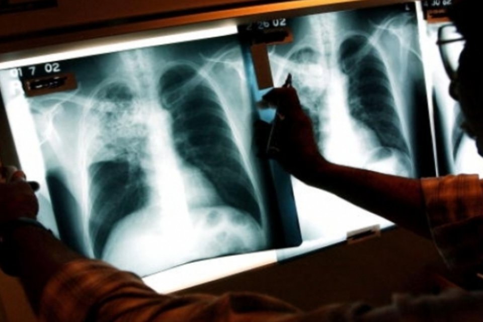 Tuberculose retrocede, mas continua sendo problema, diz OMS