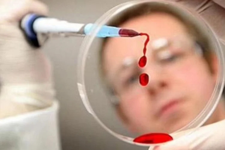 HIV: a nova tecnologia é capaz de detectar o antígeno em "concentrações 100.000 vezes inferiores" às dos sistemas atuais (Reprodução)