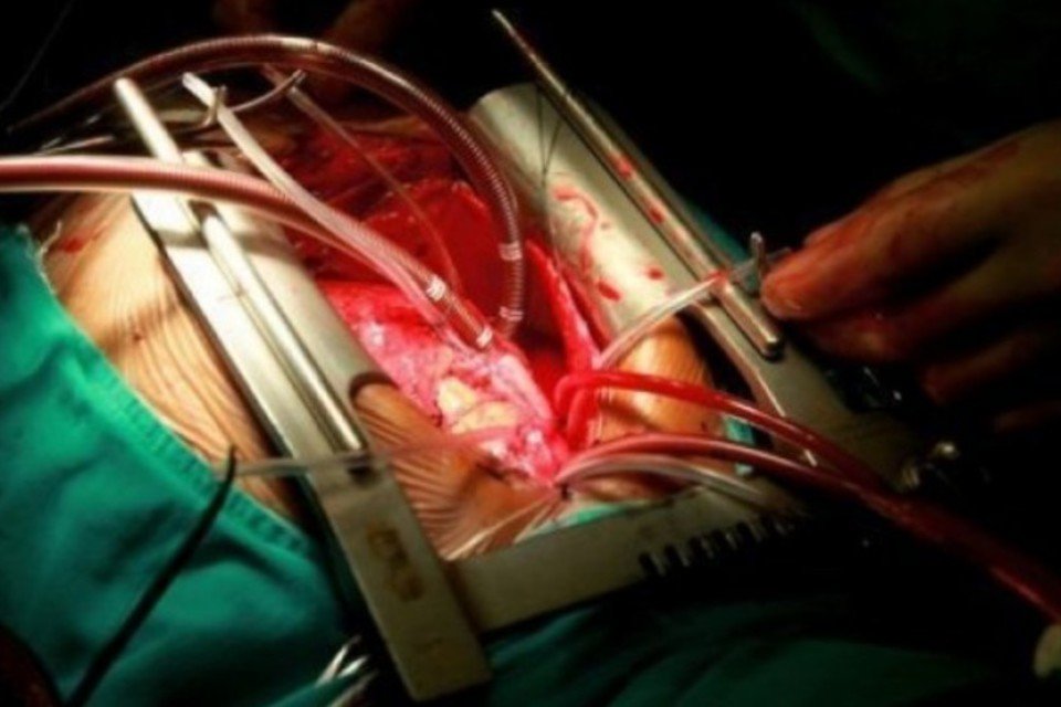 Cientistas desenvolvem tecido de coração humano