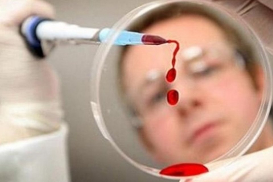 Infectologista alerta para atenção global com a Aids