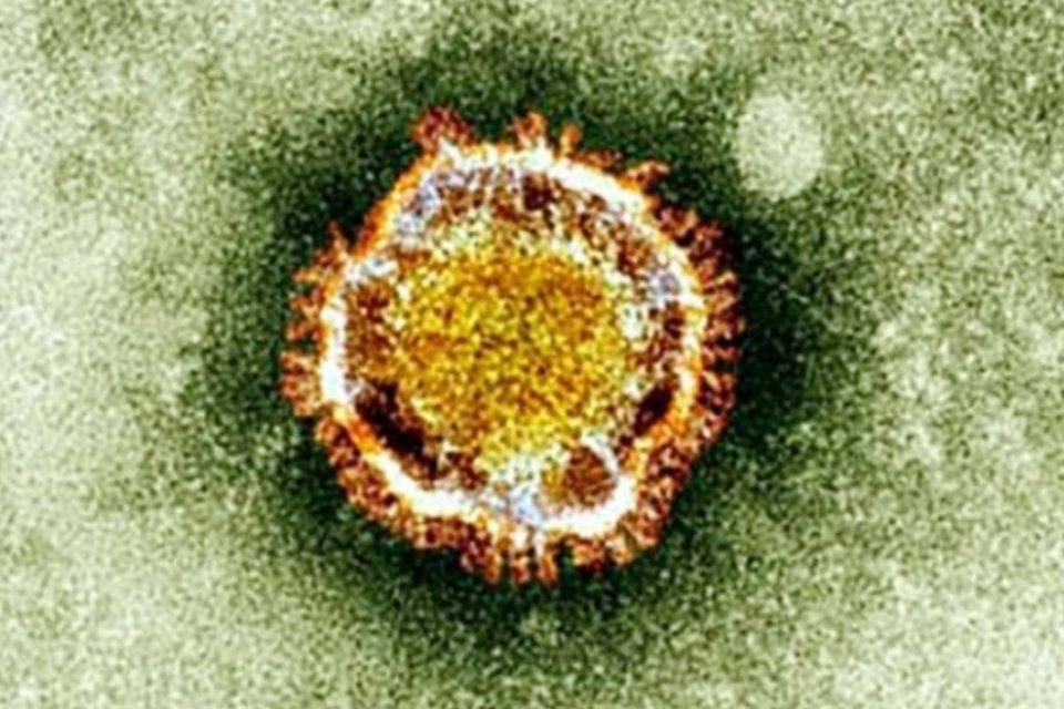 Sobe para 59 o número de mortos por coronavírus na Arábia Saudita