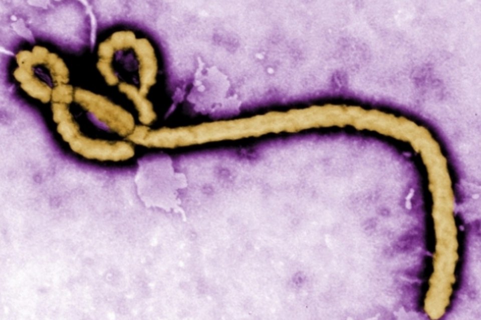 Confirmado primeiro caso de ebola transmitido sexualmente