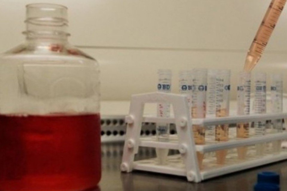 Troca de equipamento atrasa exame de HIV