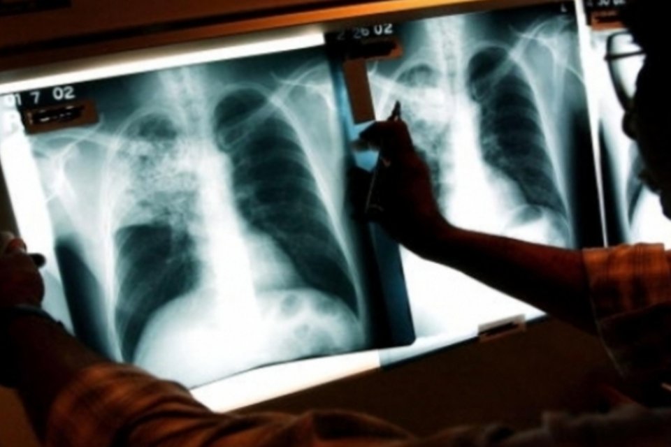 Teste rápido de tuberculose começa este mês em seis cidades do país