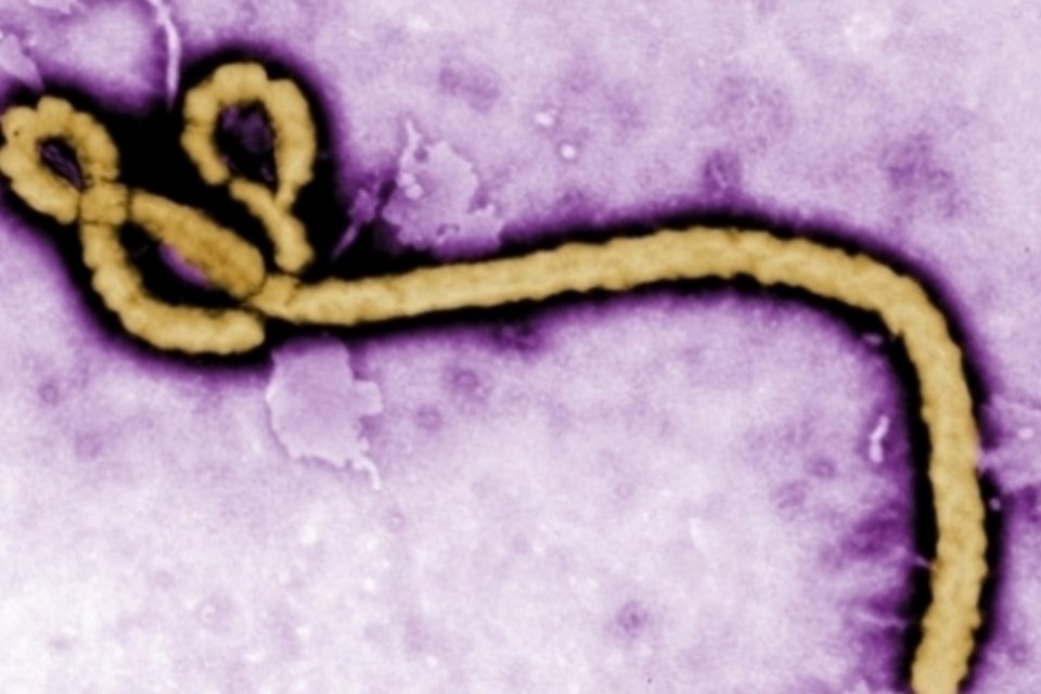 Médico contrai Ebola após tratar paciente na Nigéria