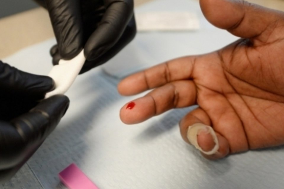 SUS oferecerá teste rápido para diagnosticar HIV com saliva