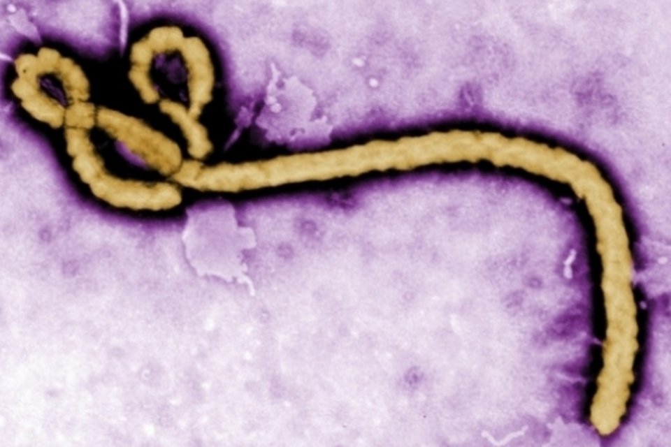 Ministério da Saúde envia cartilha sobre Ebola a hospitais