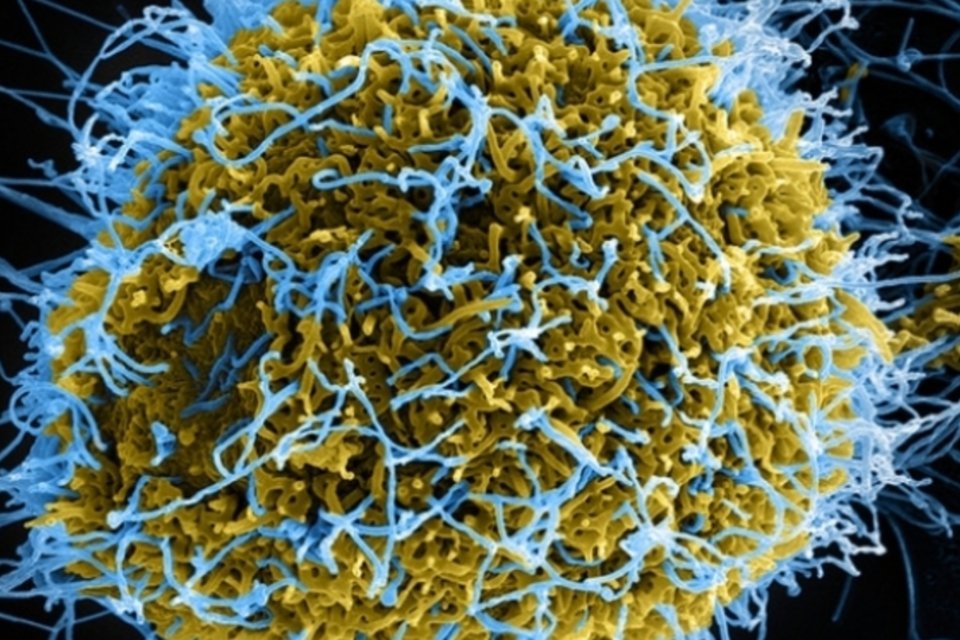 Ebola faz mais de 500 vítimas no oeste da África