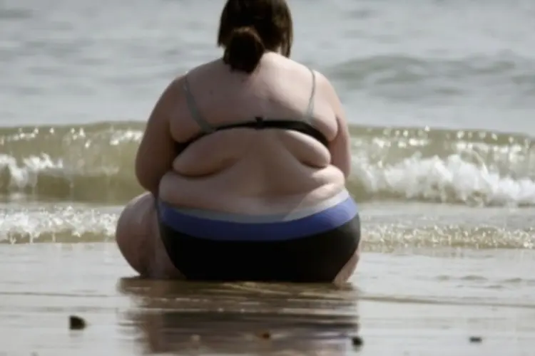 Obesidade (Matt Cardy/Getty Images)