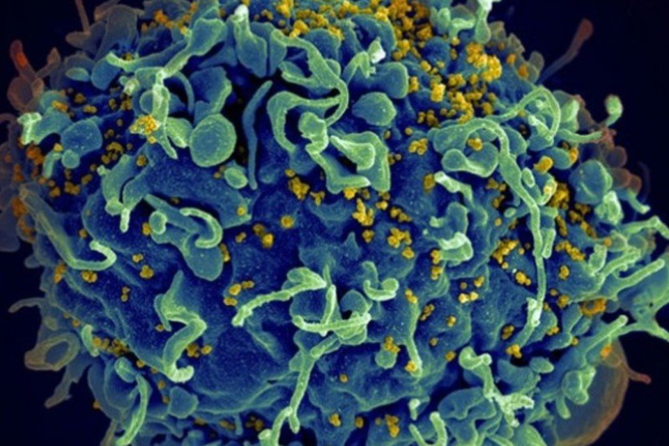 Vacina brasileira contra o HIV começará a ser testada em macacos