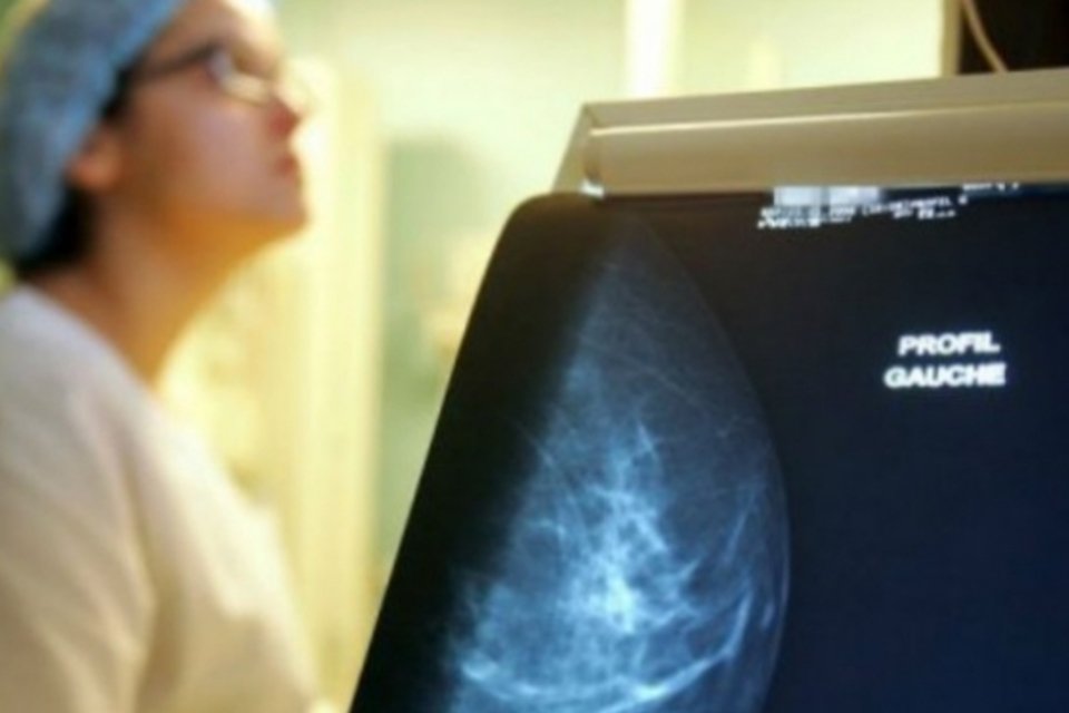 Depois dos 50, mamografia será sem marcação em SP