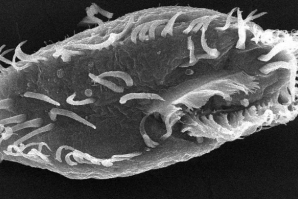 Oxytricha trifallax (Wikimedia Commons)