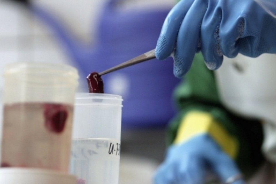 Células-tronco: as pacientes tiveram que pagar pelo procedimento, o que é um sinal de fraude (foto/Getty Images)