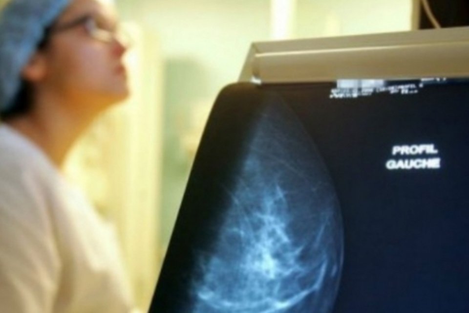 Mamografia sem pedido médico já pode ser agendada em SP