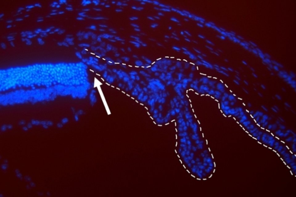 Pesquisa encontra novo método para reparo da retina