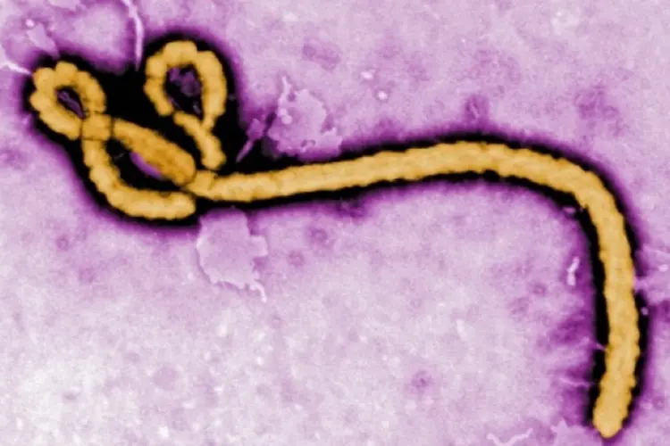 ebola (Getty Images)