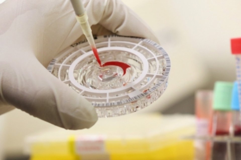 Vacinas e transfusões de sangue são possíveis soluções ao ebola