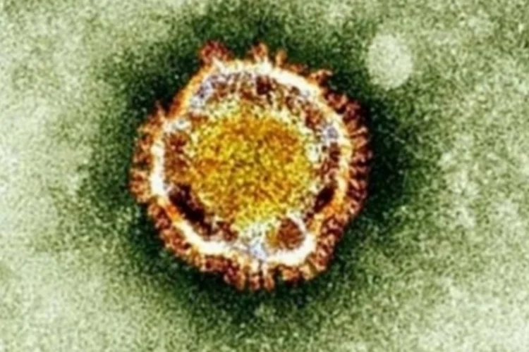 MERS (AFP)