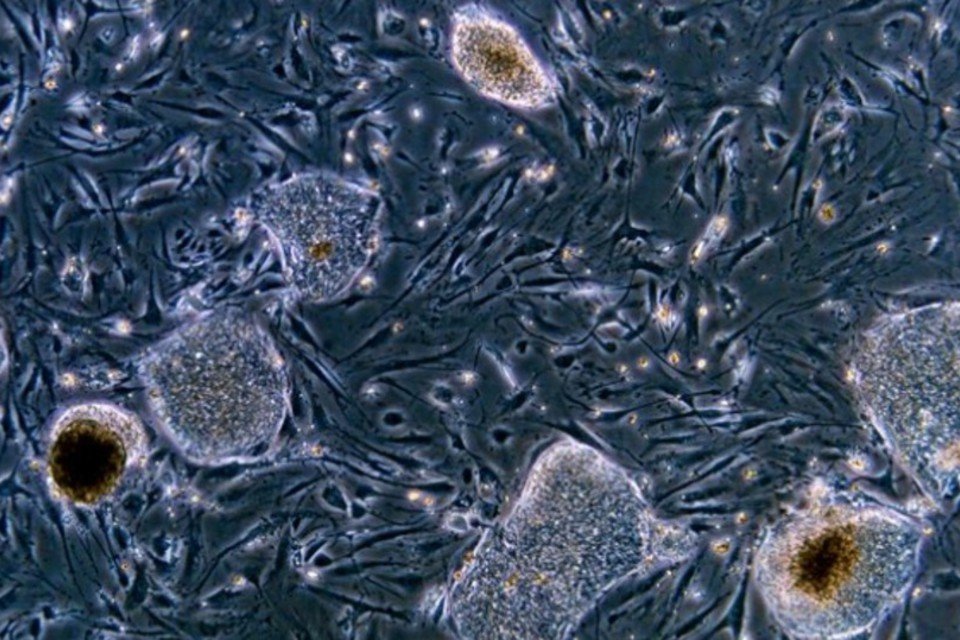 Grupo cria fígado humano a partir de células tronco