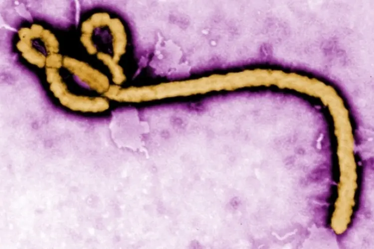 Ebola (Getty Images)