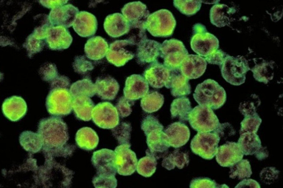 Ameba que come o cérebro infecta garoto nos EUA