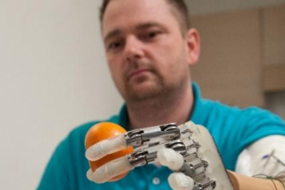 Amputado tem implantada prótese de mão que restitui o tato