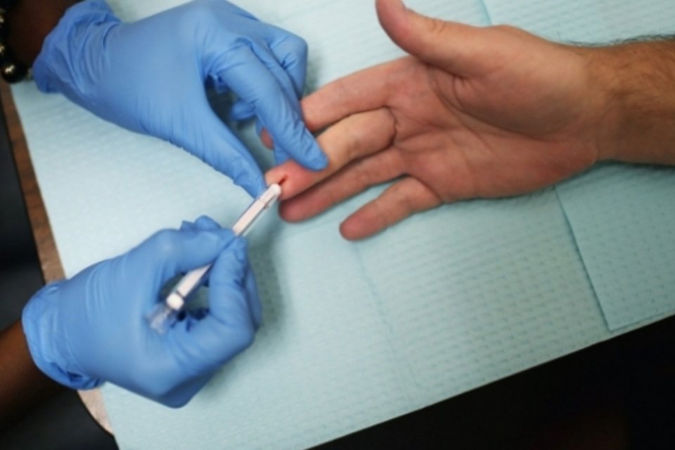 Traços de HIV voltam a aparecer após transplante de medula