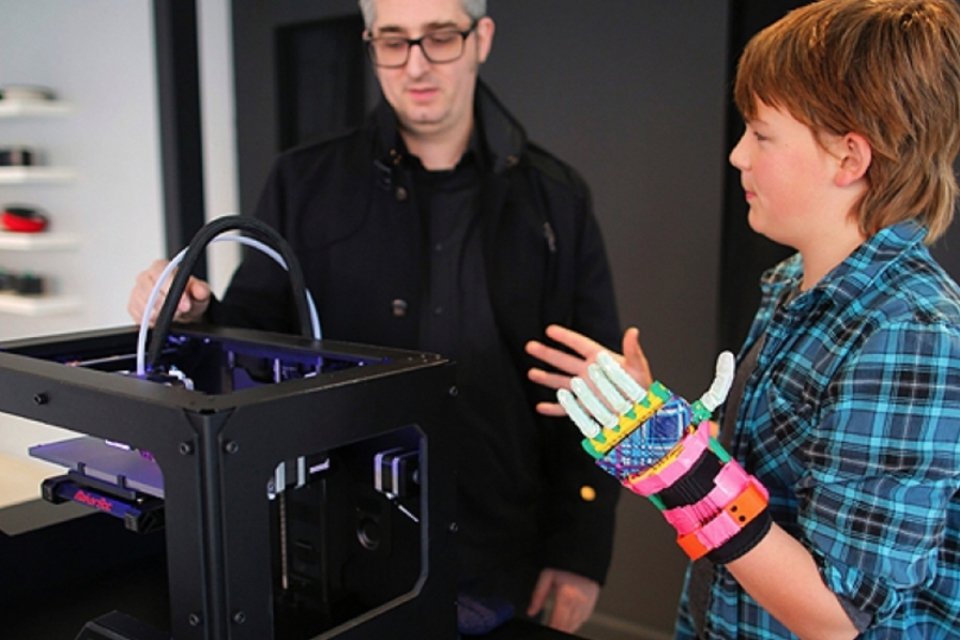 Criança vai receber prótese de mão impressa em 3D na França