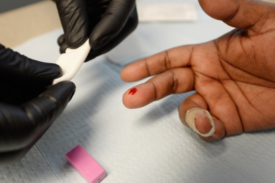 Novas pesquisas impulsionam busca de cientistas pela cura da Aids