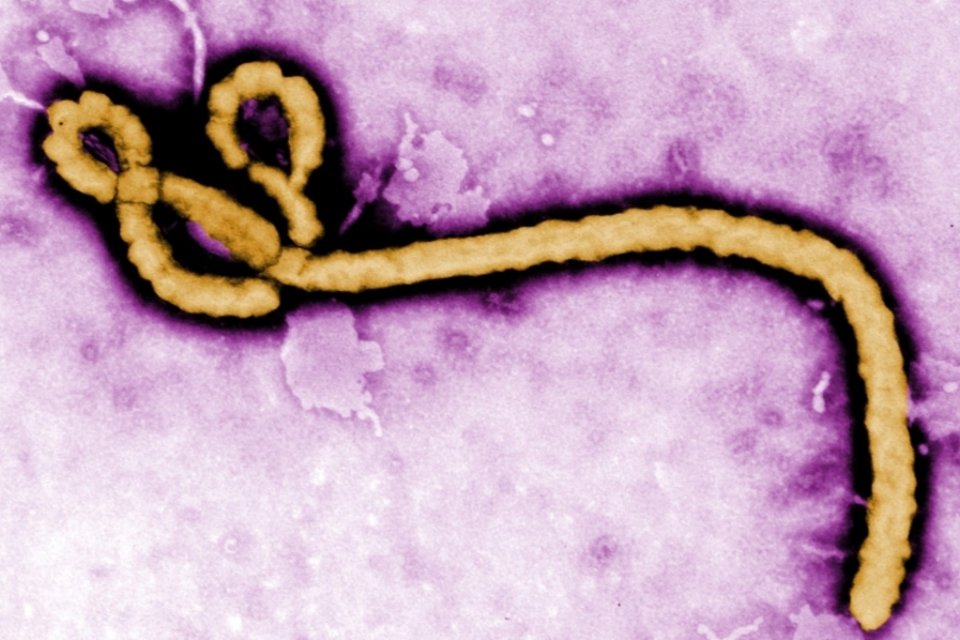 Ebola pode persistir no sêmen por nove meses, segundo estudos