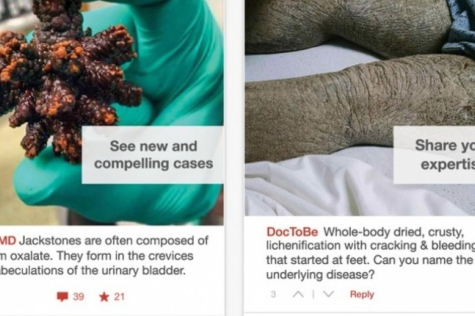 Aplicativo Figure1, o Instagram dos médicos, reúne casos bizarros e curiosos