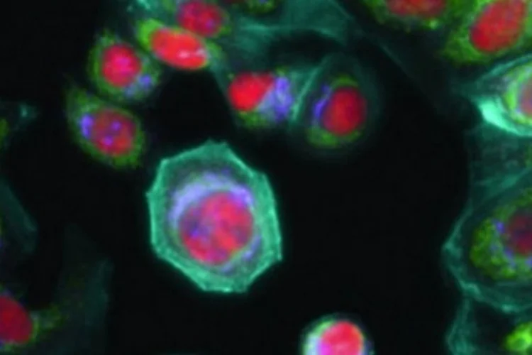 cancer (Ge Healthcare/flickr)
