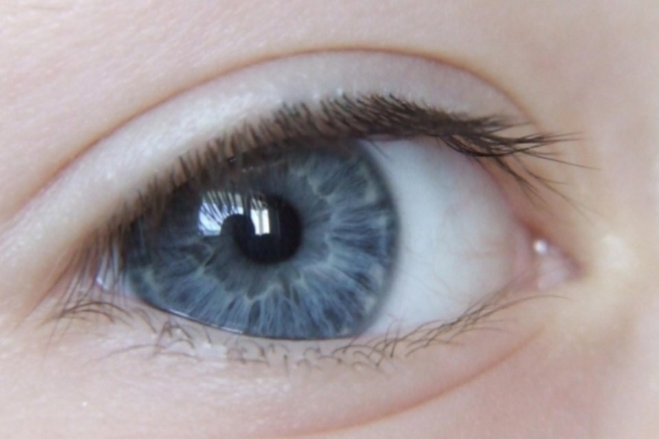 Empresa californiana promete tornar olhos castanhos em azuis com técnica a laser