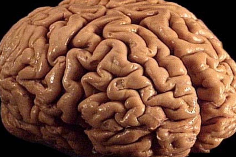 Cérebro maior não é sinônimo de mais inteligência, diz estudo